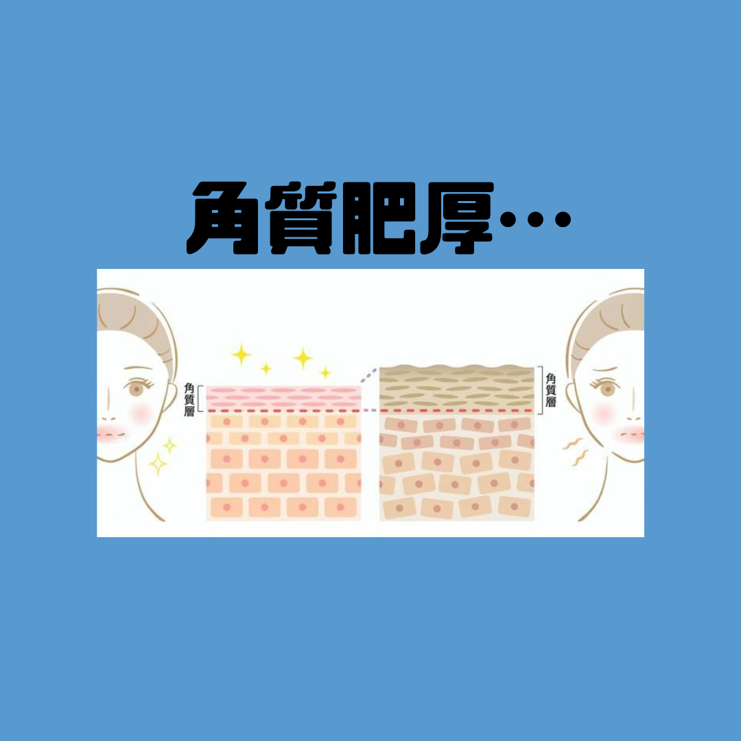 角質がたまる原因と対策について